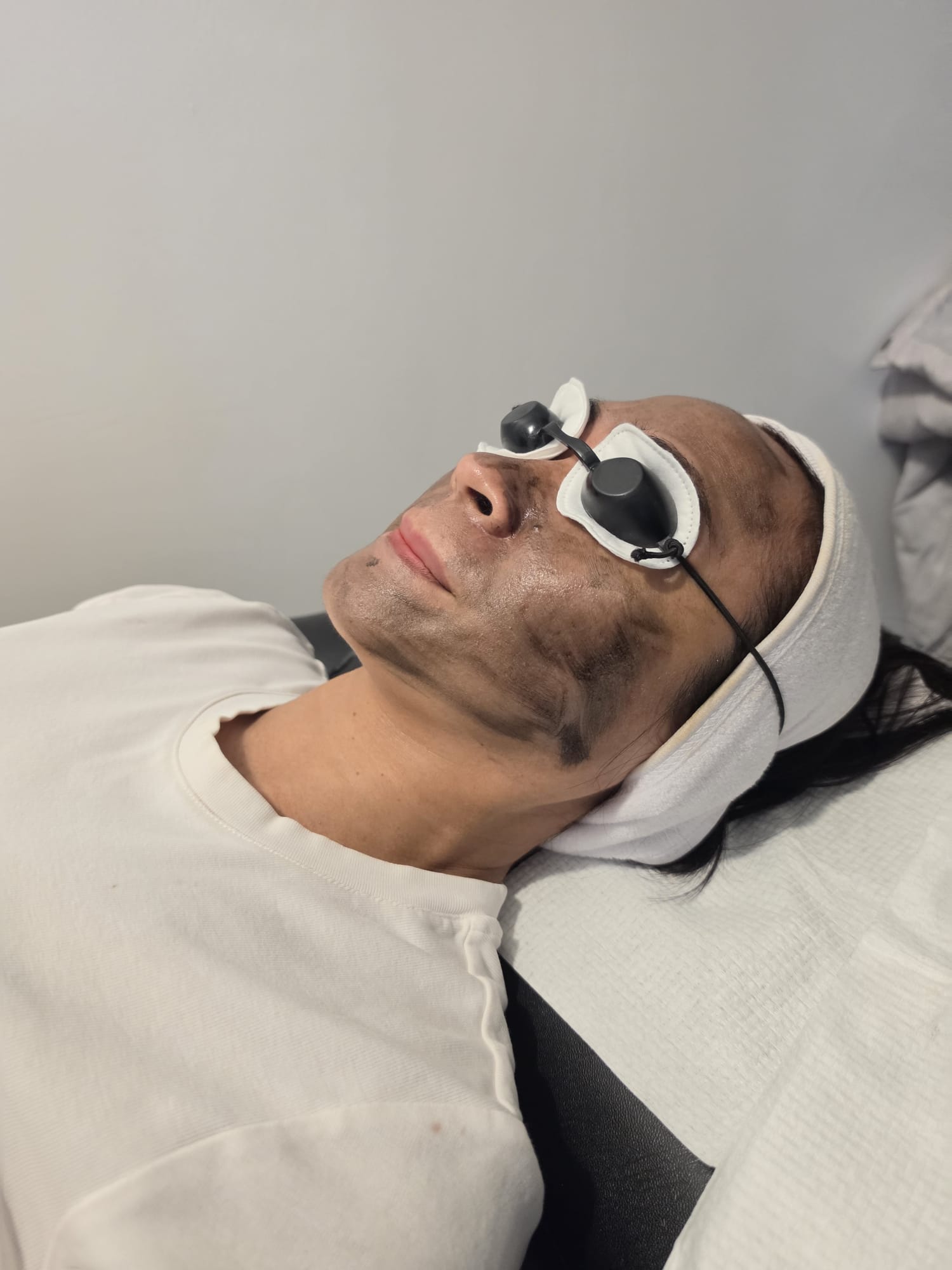 Client resting with the carbon mask on and laser goggles fitted during a Carbon Facial